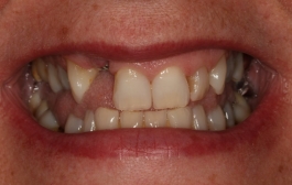 Smile Gallery - Church Road Dental and Cosmetic