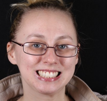 Smile Gallery - Church Road Dental and Cosmetic