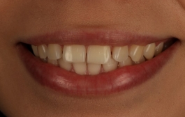 Smile Gallery - Church Road Dental and Cosmetic