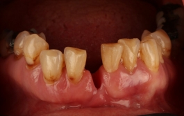 Smile Gallery - Church Road Dental and Cosmetic
