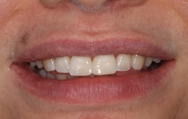 Smile Gallery - Church Road Dental and Cosmetic