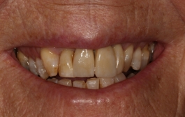 Smile Gallery - Church Road Dental and Cosmetic