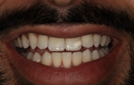 Smile Gallery - Church Road Dental and Cosmetic