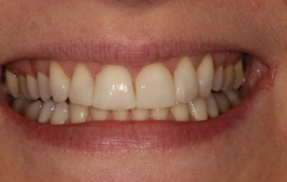 Smile Gallery - Church Road Dental and Cosmetic