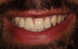 Smile Gallery - Church Road Dental and Cosmetic