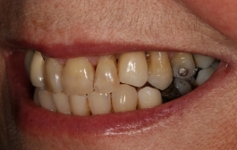 Smile Gallery - Church Road Dental and Cosmetic