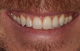 Smile Gallery - Church Road Dental and Cosmetic