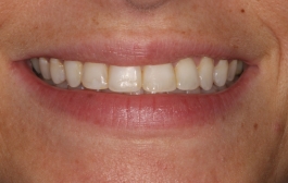 Smile Gallery - Church Road Dental and Cosmetic