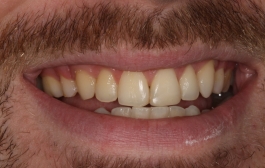 Smile Gallery - Church Road Dental and Cosmetic