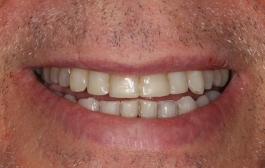 Smile Gallery - Church Road Dental and Cosmetic