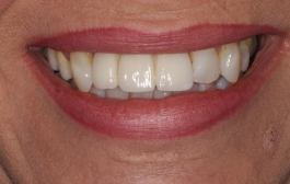 Smile Gallery - Church Road Dental and Cosmetic