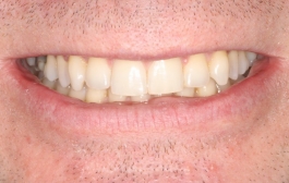 Smile Gallery - Church Road Dental and Cosmetic