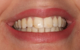 Smile Gallery - Church Road Dental and Cosmetic