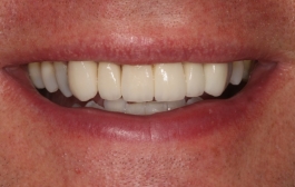 Smile Gallery - Church Road Dental and Cosmetic