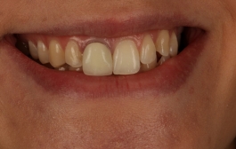Smile Gallery - Church Road Dental and Cosmetic