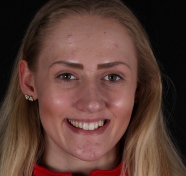 Smile Gallery - Church Road Dental and Cosmetic