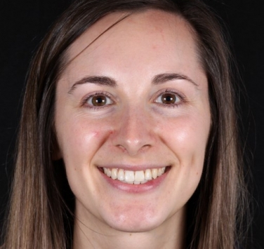 Smile Gallery - Church Road Dental and Cosmetic