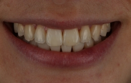 Smile Gallery - Church Road Dental and Cosmetic