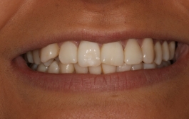 Smile Gallery - Church Road Dental and Cosmetic