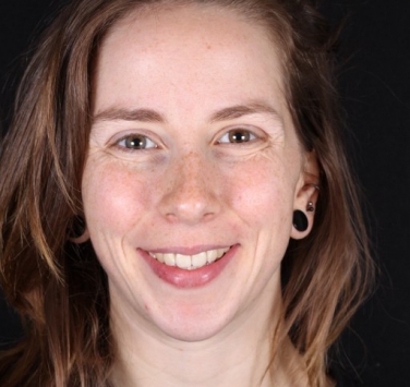 Smile Gallery - Church Road Dental and Cosmetic