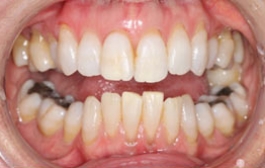 Smile Gallery - Church Road Dental and Cosmetic
