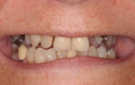 Smile Gallery - Church Road Dental and Cosmetic