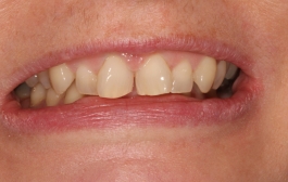 Smile Gallery - Church Road Dental and Cosmetic