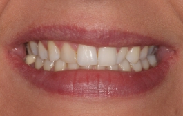 Smile Gallery - Church Road Dental and Cosmetic