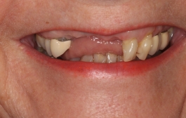 Smile Gallery - Church Road Dental and Cosmetic