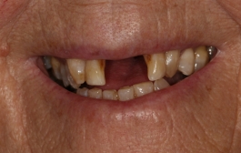 Smile Gallery - Church Road Dental and Cosmetic