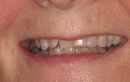 Smile Gallery - Church Road Dental and Cosmetic