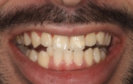 Smile Gallery - Church Road Dental and Cosmetic