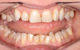 Smile Gallery - Church Road Dental and Cosmetic