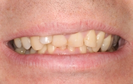 Smile Gallery - Church Road Dental and Cosmetic