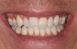 Smile Gallery - Church Road Dental and Cosmetic
