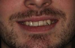 Smile Gallery - Church Road Dental and Cosmetic