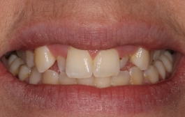 Smile Gallery - Church Road Dental and Cosmetic