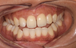 Smile Gallery - Church Road Dental and Cosmetic