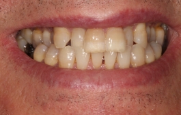 Smile Gallery - Church Road Dental and Cosmetic