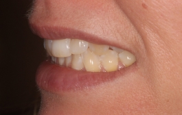 Smile Gallery - Church Road Dental and Cosmetic