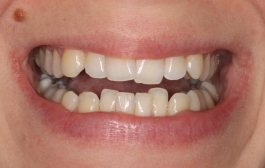 Smile Gallery - Church Road Dental and Cosmetic