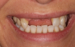 Smile Gallery - Church Road Dental and Cosmetic