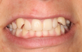 Smile Gallery - Church Road Dental and Cosmetic