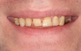 Smile Gallery - Church Road Dental and Cosmetic