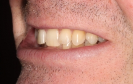 Smile Gallery - Church Road Dental and Cosmetic