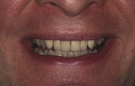 Smile Gallery - Church Road Dental and Cosmetic