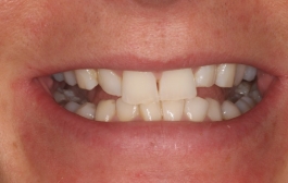 Smile Gallery - Church Road Dental and Cosmetic