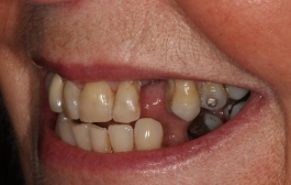 Smile Gallery - Church Road Dental and Cosmetic