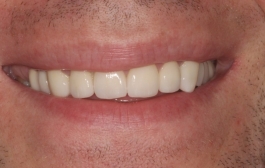 Smile Gallery - Church Road Dental and Cosmetic