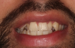 Smile Gallery - Church Road Dental and Cosmetic